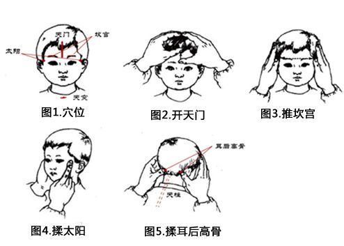 中医推拿治疗小儿感冒咳嗽图片1