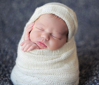 新生儿寒冷损伤综合征图片1