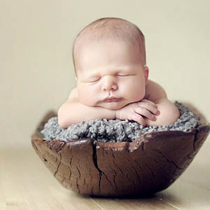 什么是先天畸形图片1