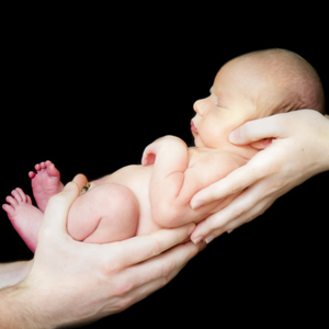 新生儿胆红素脑病的症状图片1