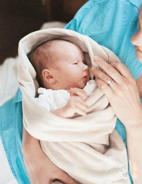 新生儿病理性黄疸治疗方法图片1 新生儿病理性黄疸治疗方法图片1